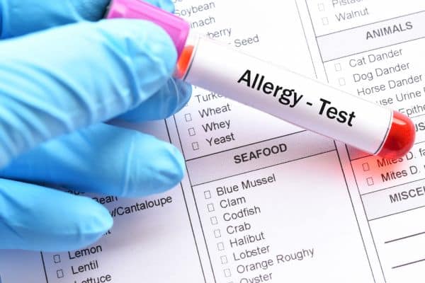 A tube of blood with a label that reads "allergy testing"