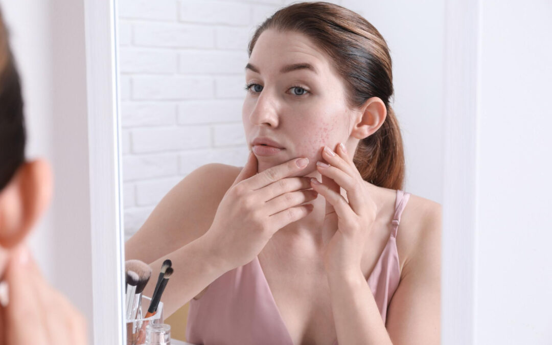 hormonal imbalance
