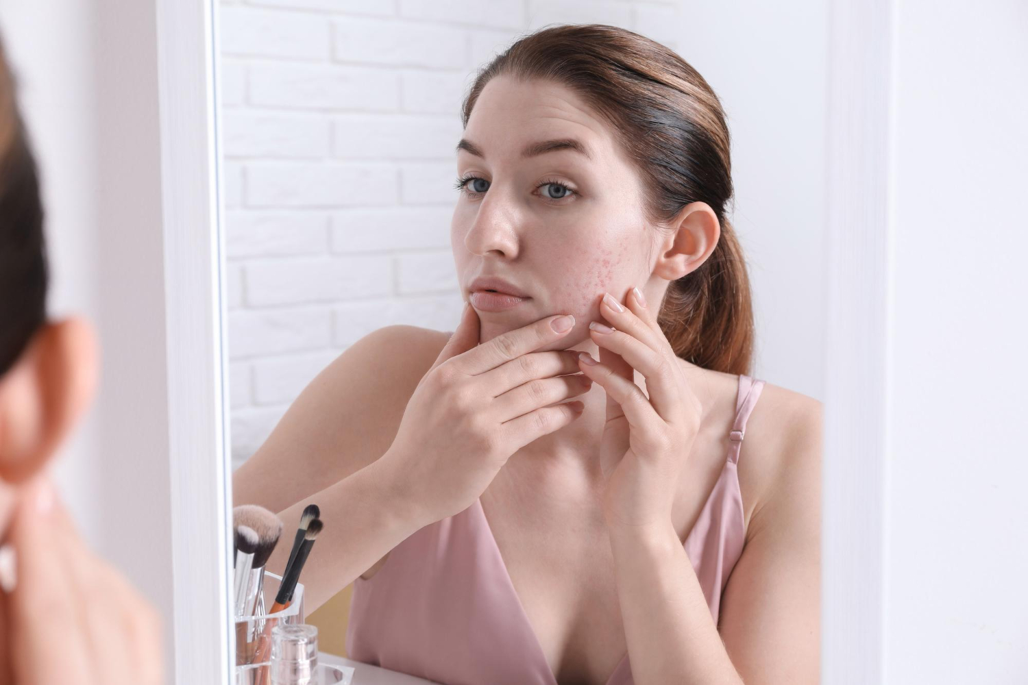 hormonal imbalance