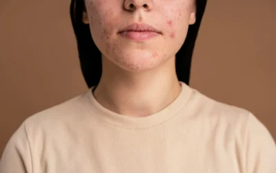 When to See a Dermatologist: Signs Your Skin Needs Expert Care