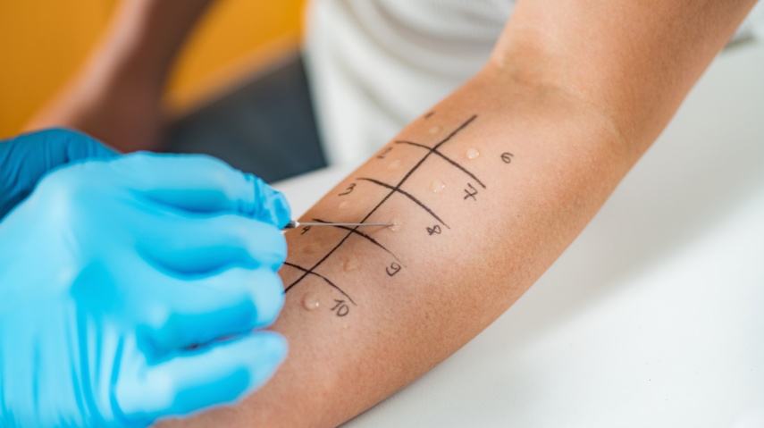 How Accurate Are Allergy Tests? Understanding False Positives and Negatives