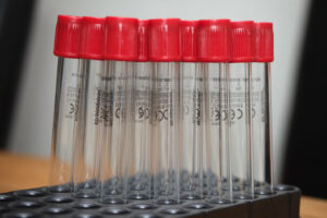 Blood test tubes in a medical laboratory